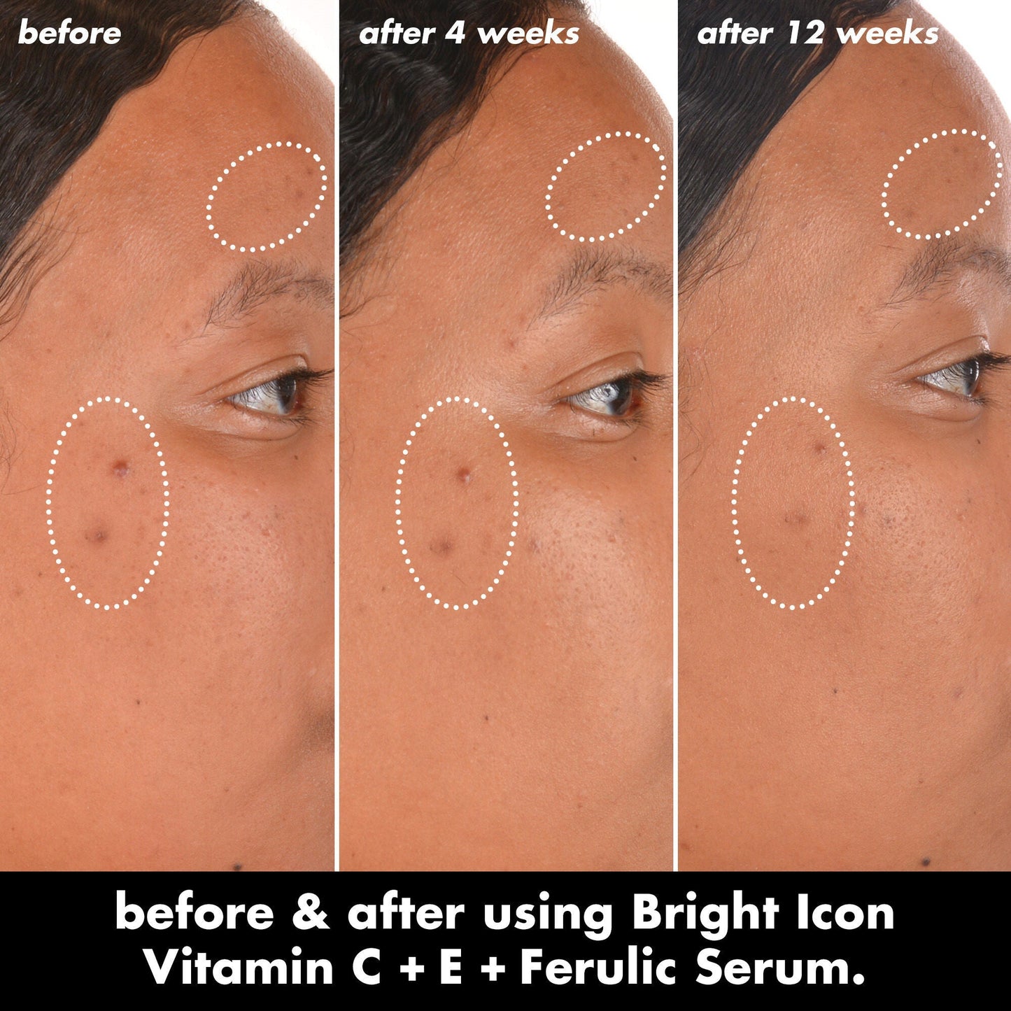 bright-icon-vitamin-c-e-ferulic-serum-q5 0226_EDU_BrightIconVitC_BA_Chanel_TRIPTYCH_c58f2fc8-209d-414f-9ba3-666a07a94887.jpg