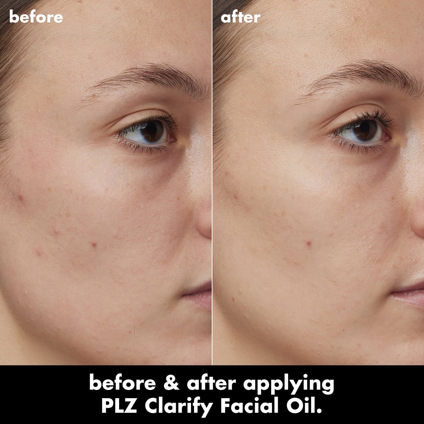 plz-clarify-facial-oil-w0 0326_EDU_PlzClarify_BA_Kelly.jpg