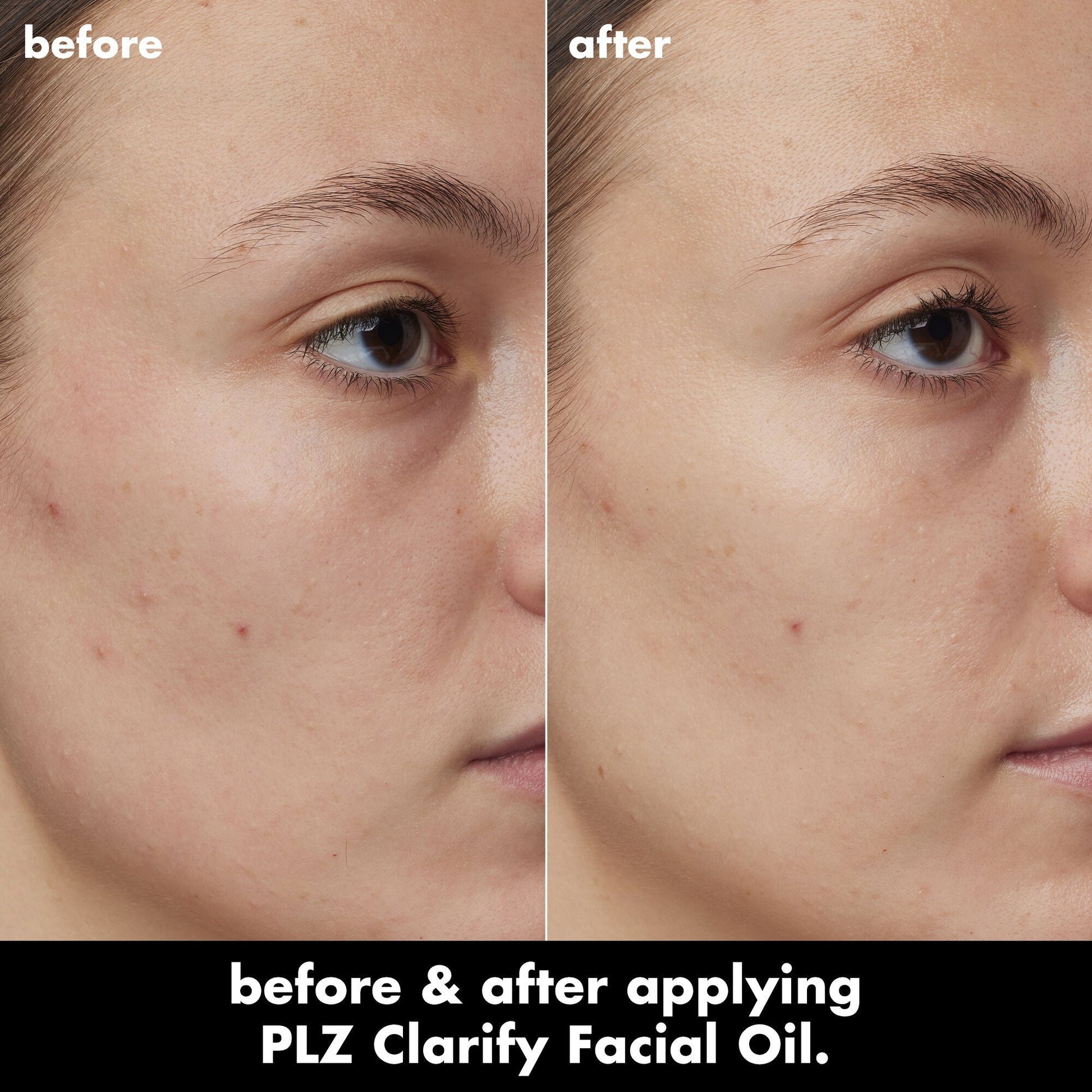 plz-clarify-facial-oil-w0 0326_EDU_PlzClarify_BA_Kelly.jpg