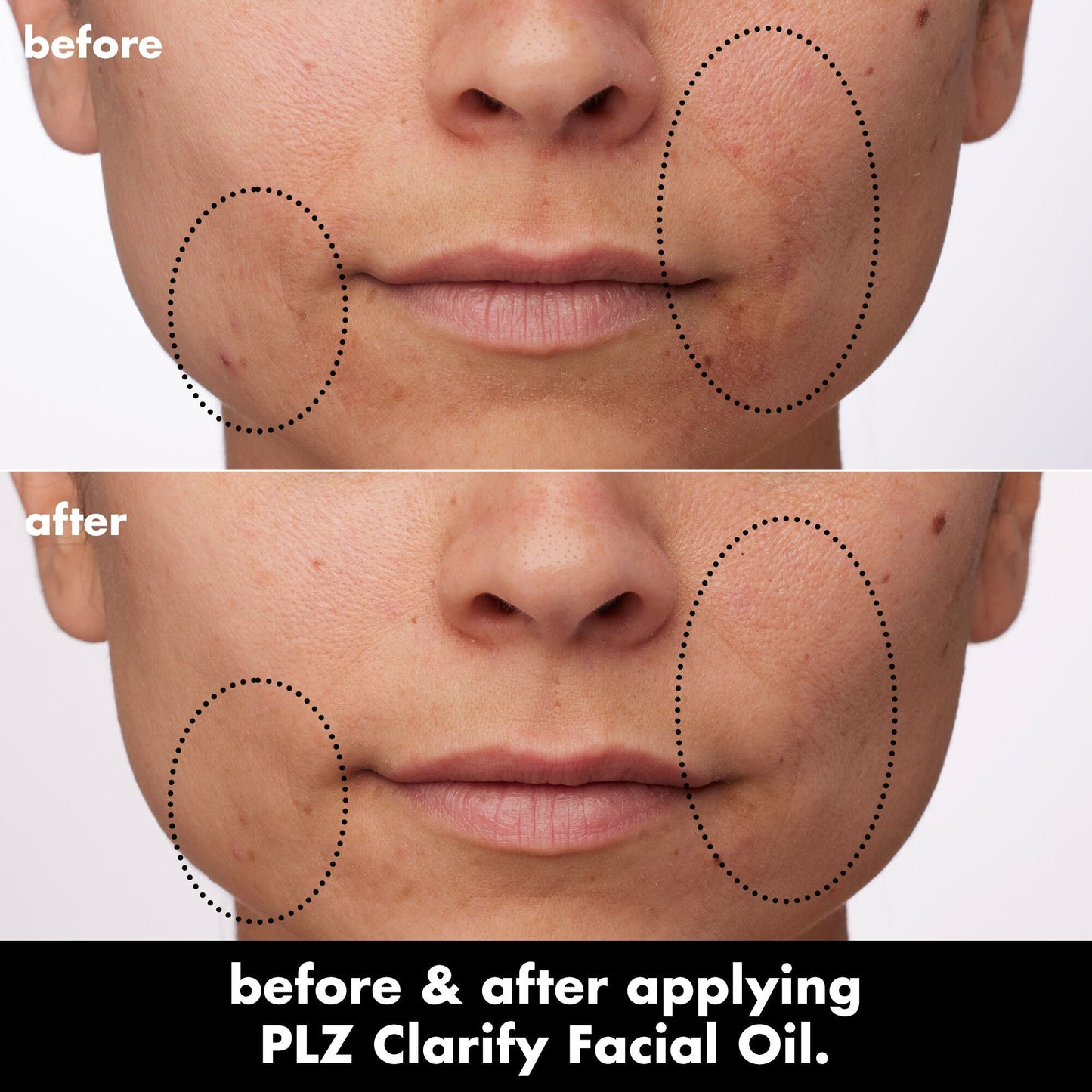 plz-clarify-facial-oil-w0 0326_EDU_PlzClarify_BA_Paula.jpg