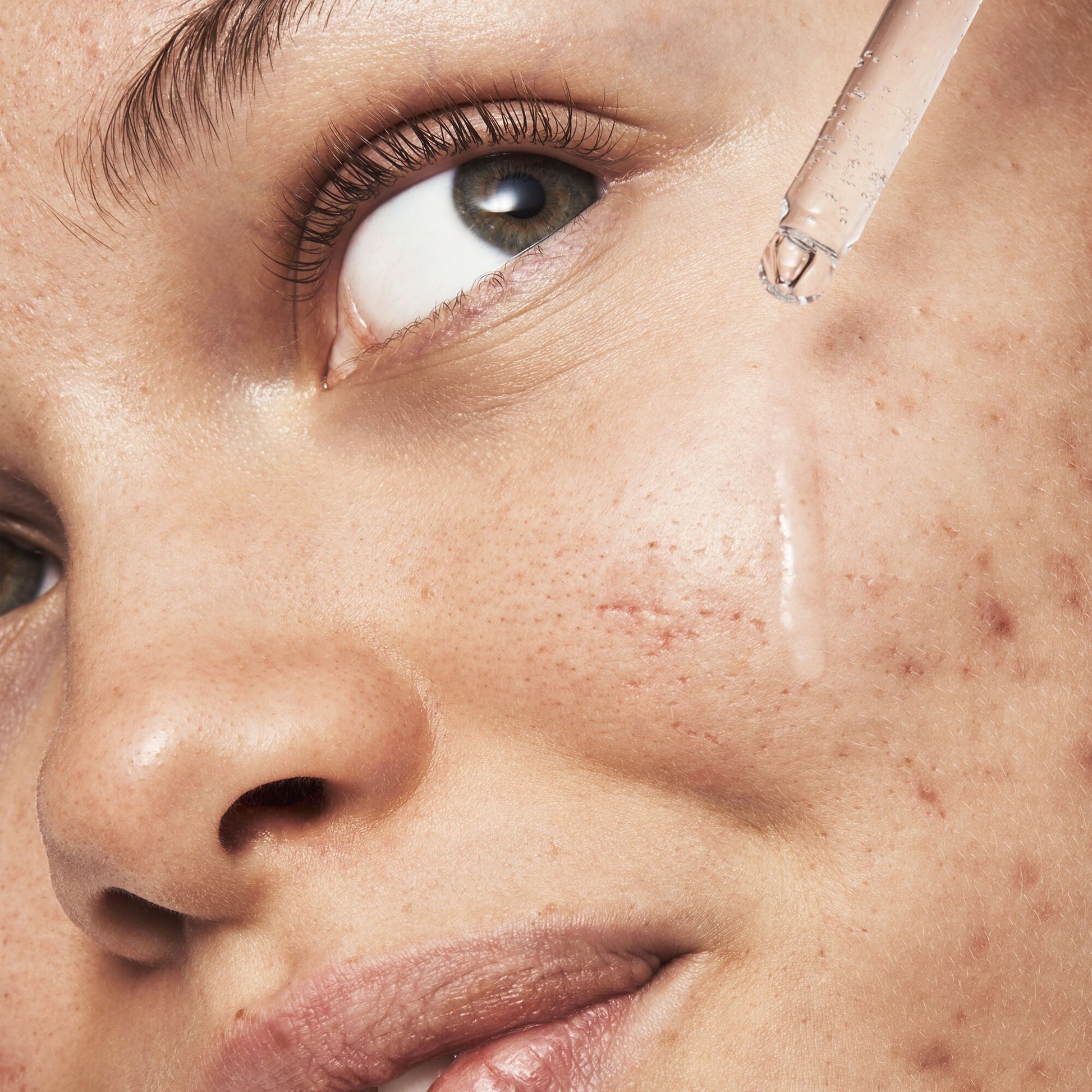 blemish-breakthrough-triple-acid-resurfacing-serum-m5 121321_Marley-Acne-Regimen_0254_FINAL_IGF.jpg
