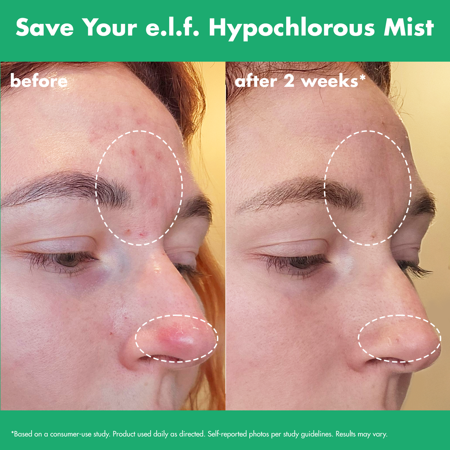 save-your-e-l-f-hypochlorous-mist-a2 FA26_EDUCATION_SAVEYOURELF_USAGE_BA1_WITHOUT_CLAIMS.png