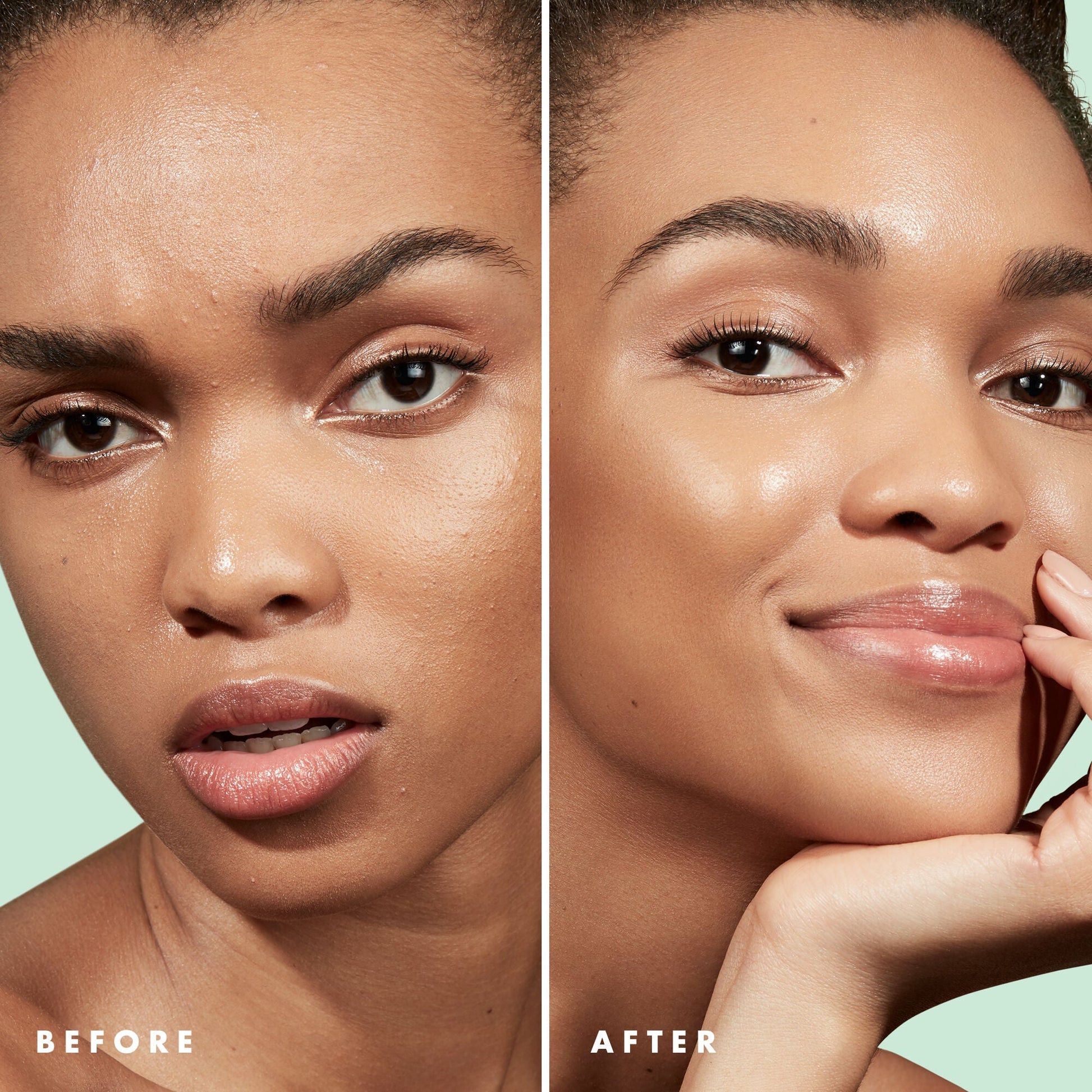 blemish-control-face-primer-large-size-c4 Primer_PP_Before_After_BlemishControl_2000x2000_3774231e-d4e1-49dd-b3d7-a73cbac901fe.jpg